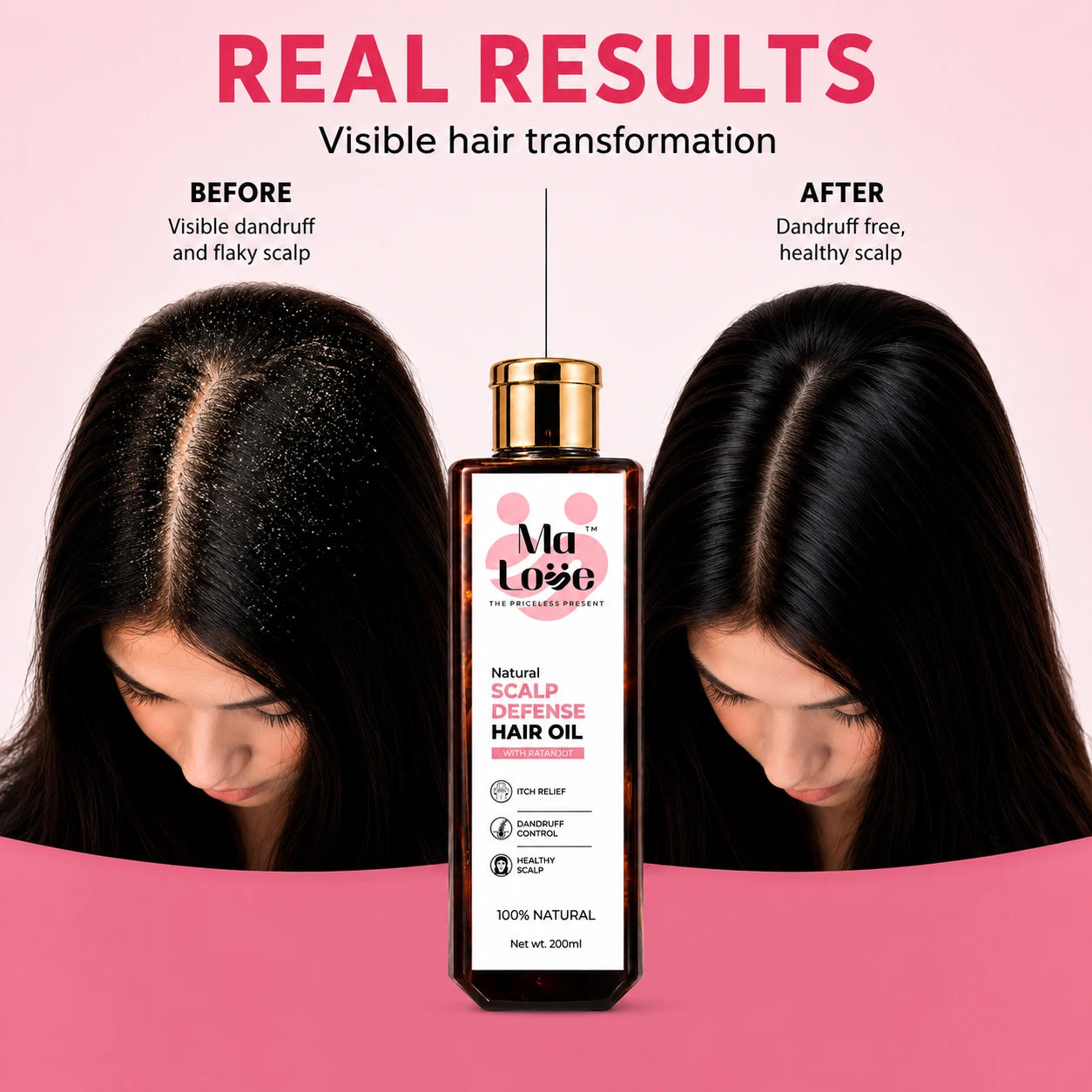 Scalp Defense Hair Oil