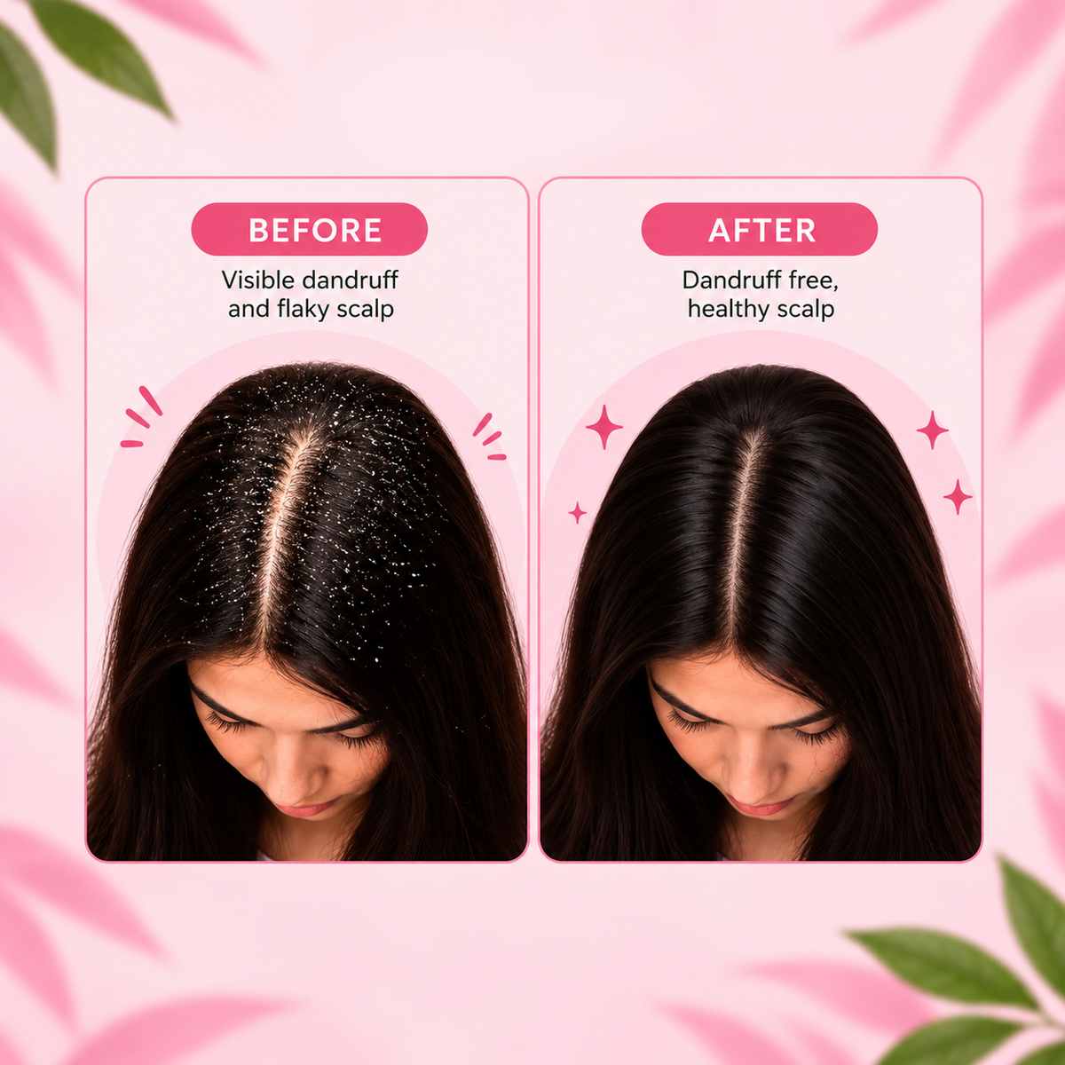 Scalp Defense Hair Oil