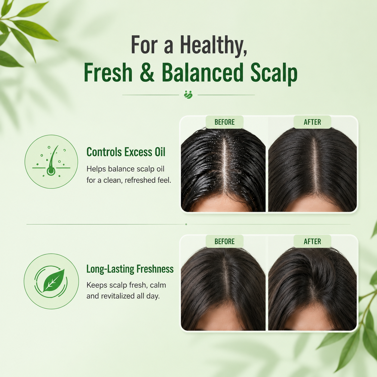 Flake Off Tea Tree & Pro-Vitamin B5 Anti-Dandruff Shampoo